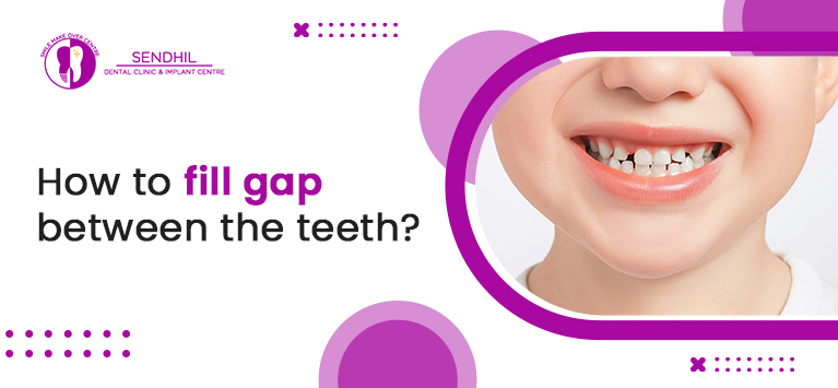 How to fill gap between the teeth