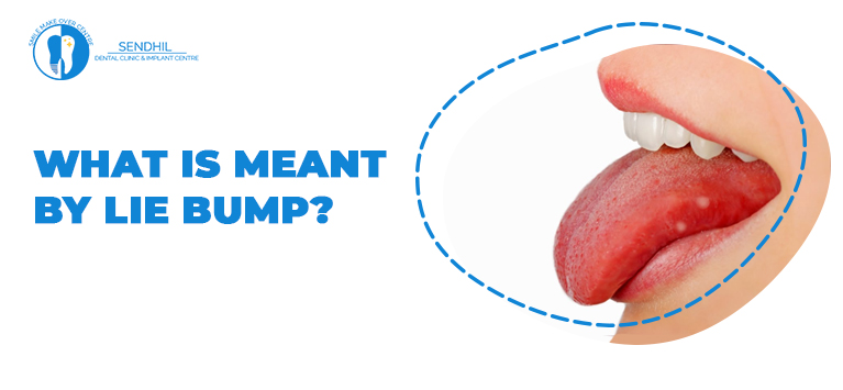 What is meant by Lie bump?