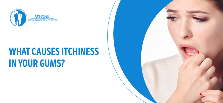 What causes itchiness in your gums ?