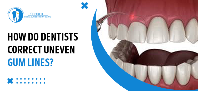 How do dentists correct uneven gum lines?