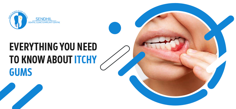 Everything you need to know about itchy gums