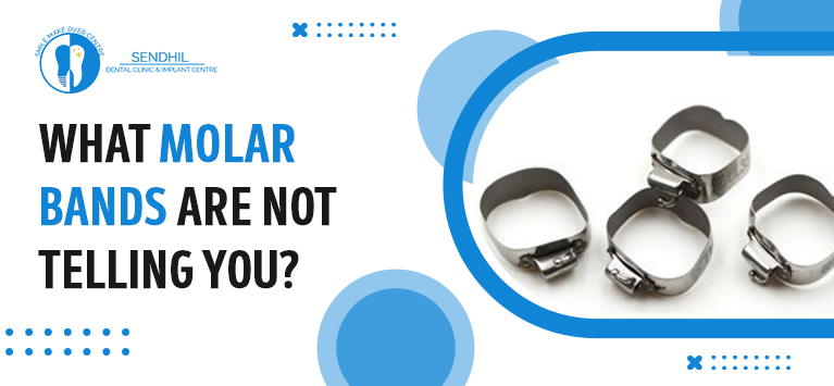 What molar bands are not telling you?