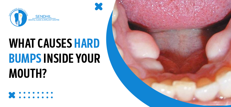 What causes hard bumps inside your mouth?