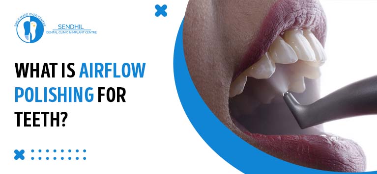 What is airflow polishing for teeth?
