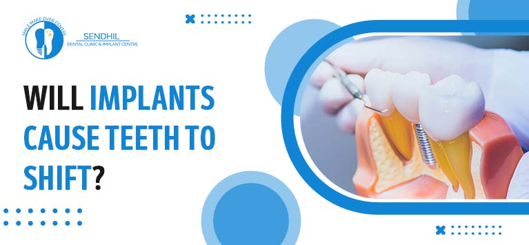 Will implants cause teeth to shift?