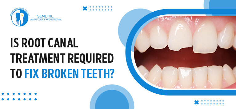 Is Root Canal Treatment required to fix broken teeth?