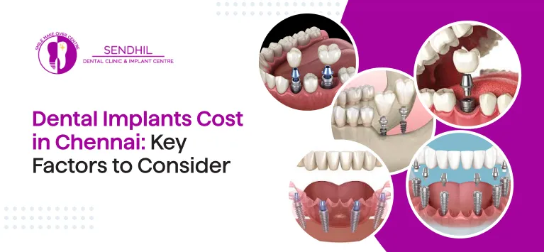 dental implant cost in chennai