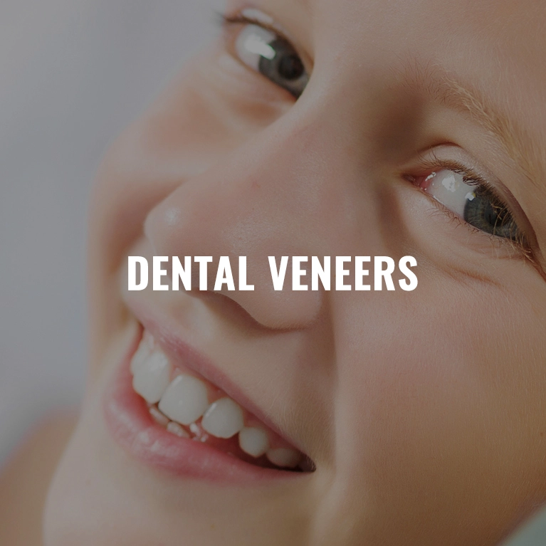 Best Dental Veneers in Chennai