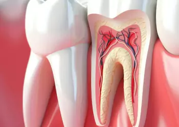 Root Canal Treatment