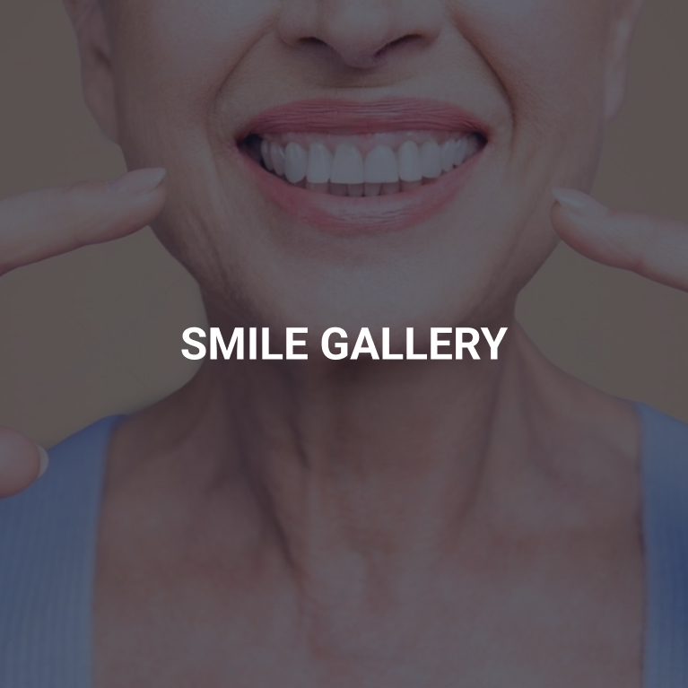 Smile Gallery