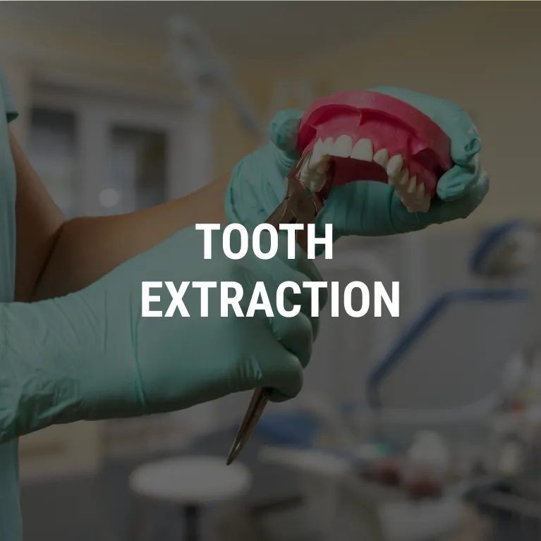 Tooth Extraction in Chennai