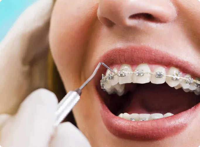 Best Orthodontists in Chennai