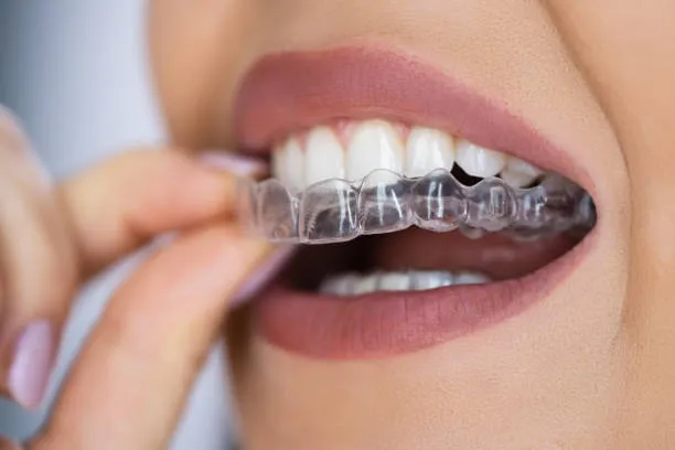 Best Orthodontists in Chennai