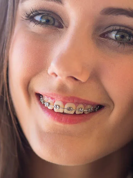 Best Orthodontists in Chennai