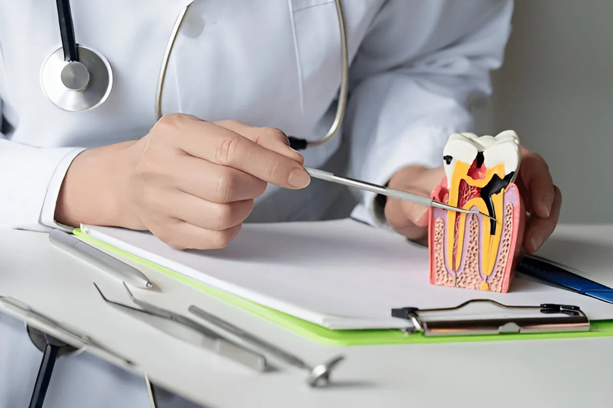 Root Canal Treatment in Chennai