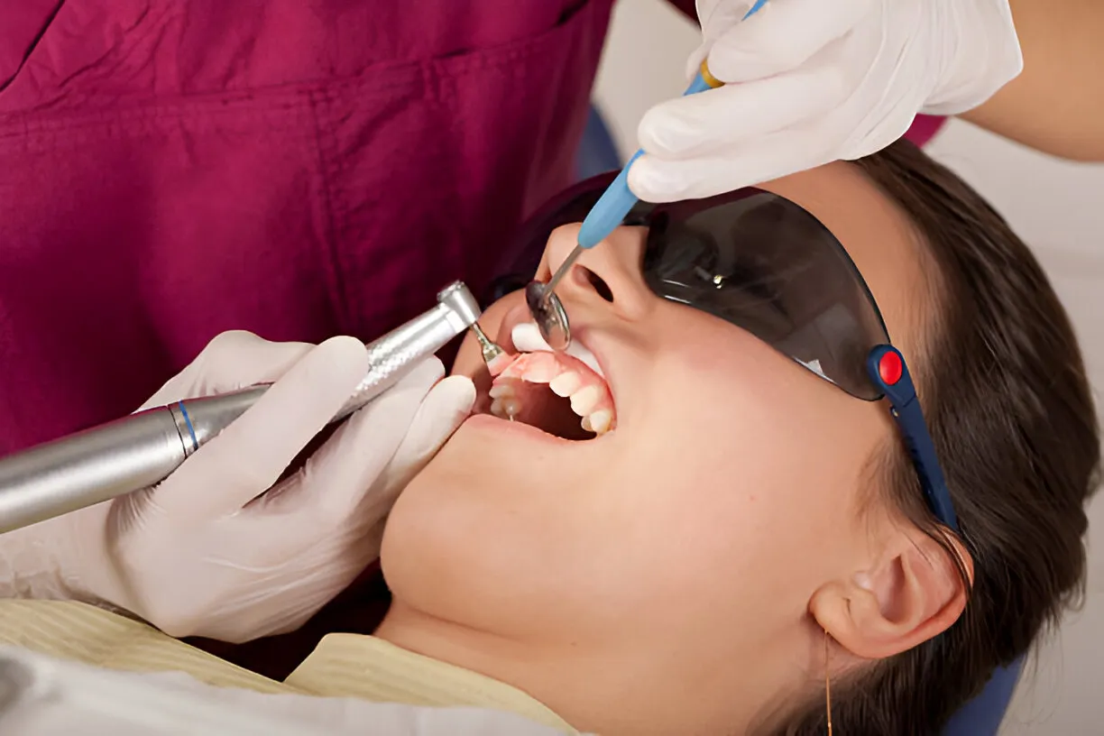 Teeth Cleaning in Chennai