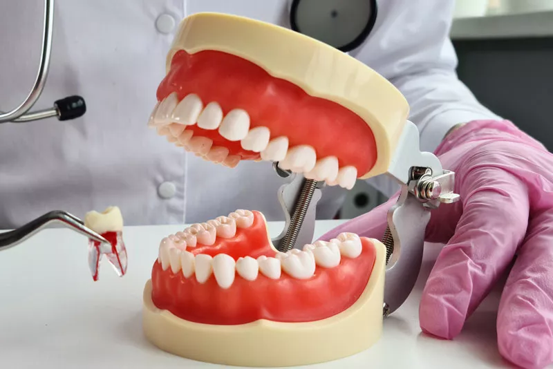 Tooth Extraction in Chennai