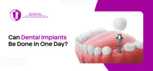 can dental implants be done in one day